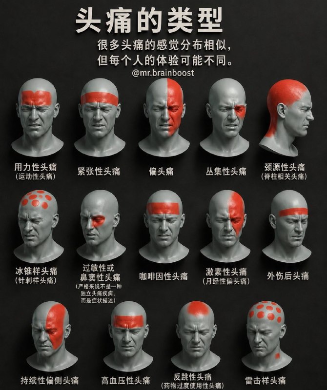 「医学科普：头痛的类型」很多头痛的感觉分布相似，但每个人的体验可能不同