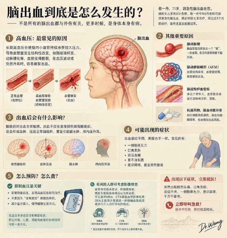 「医学科普：脑出血是如何发生的 普通人该如何预防？」敬一丹老师，因急性脑出血去世，R.I.P