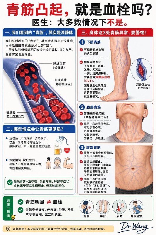 「医学科普：青筋凸起 就是长了血栓吗？」很多人照镜子时发现手臂、腿上青筋越来越明显，就开始担心是不是长血栓了？其实，大多数情况下答案是否定的！我们平时看到的"青筋"，并不是筋，而是位于皮下的浅静脉